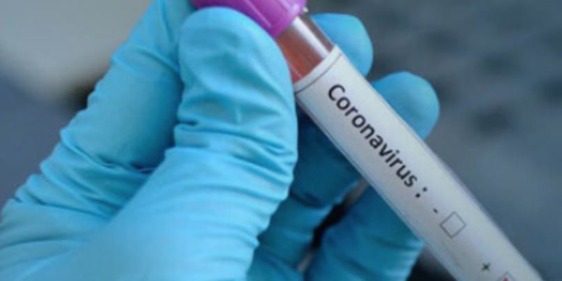 PREVENTIVE MEASURES AGAINST COVID-19